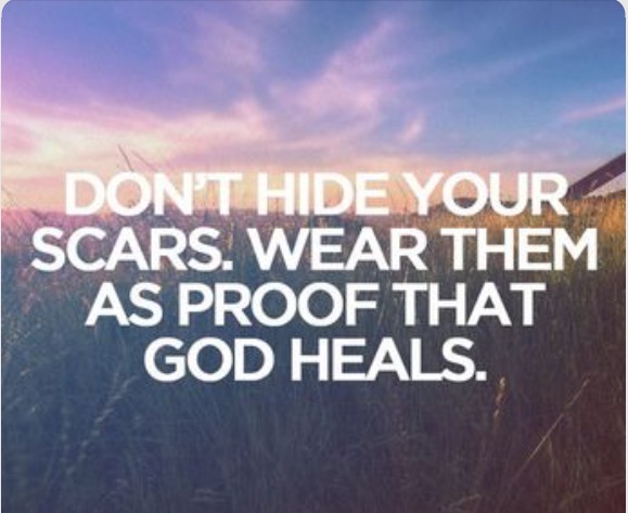 Don't Hide Your Scars
